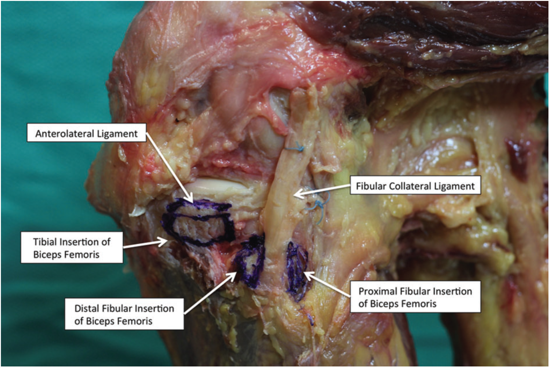 Dissection illustrating the anatomic structure